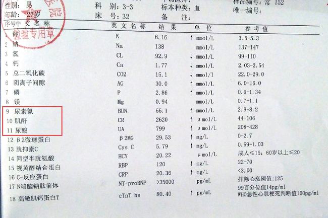 肌酐正常值最新標(biāo)準(zhǔn)2025，了解與關(guān)注的重要性